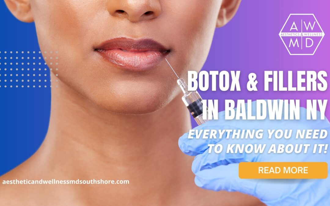 Botox for Crow’s Feet in Baldwin NY